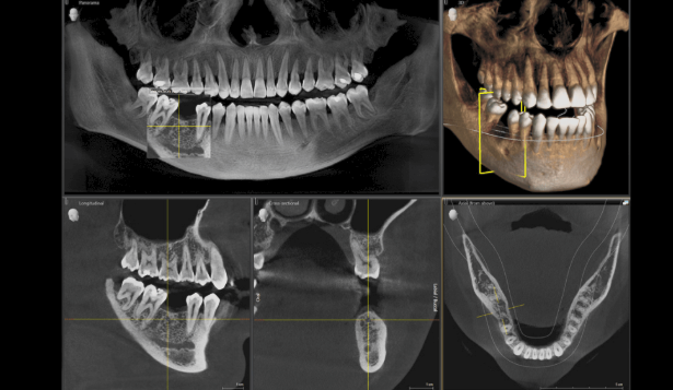 CBCT Hialeah, 3D dental imaging Hialeah, cone beam scan dentist, dental implants CBCT, oral surgery imaging, digital X-ray dentist Hialeah, Dr. Miguel Reyes DDS, Dr. Christina Reyes DDS, dental CT scan Hialeah, advanced dental diagnostics, dental imaging for implants, orthodontic imaging Hialeah
